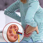 Advancements in Kidney Stone Management