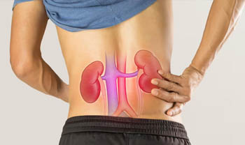 Kidney Infection