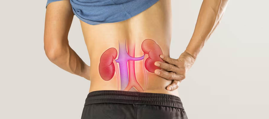 Kidney Infection: Symptoms, Causes & Treatment at Shanti Madan Hospital