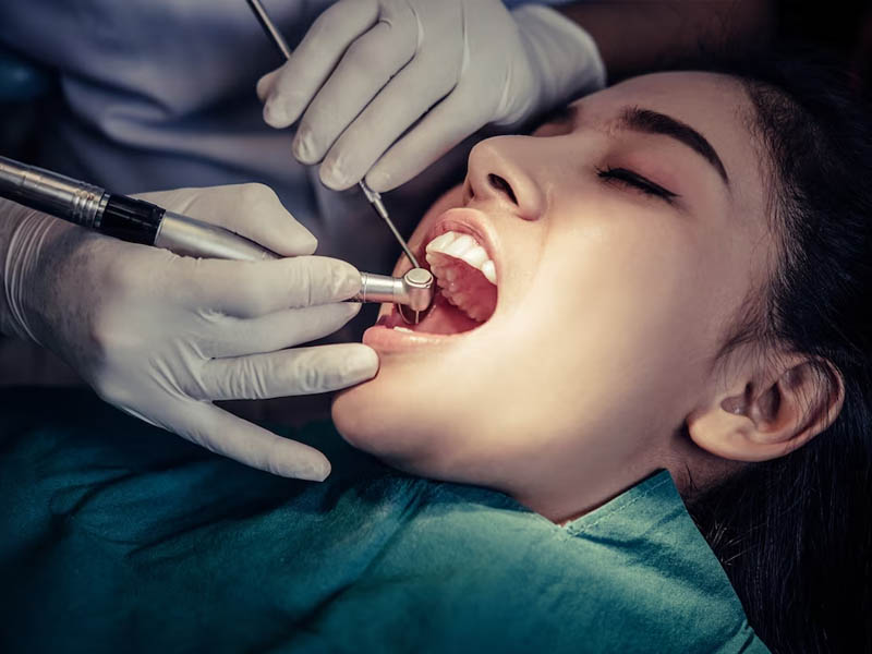 Root Canal Treatment in Muzaffarnagar