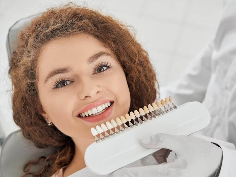 Teeth Whitening (Scaling and Bleaching)