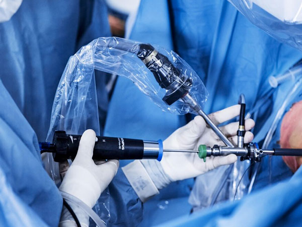 Advanced Laparoscopic Urology Muzaffarnagar